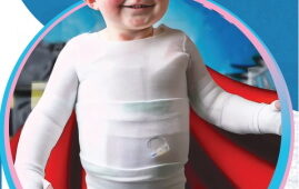 Бульозний епідермоліз