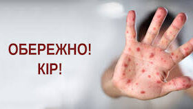 Обережно, кір!