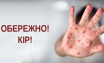 Обережно - кір!