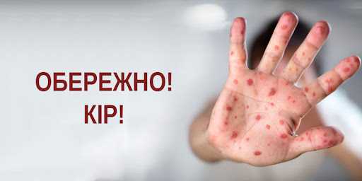 Обережно - кір!